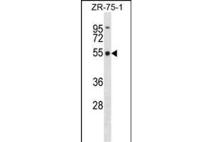 FBXO5 Antibody (Center) (ABIN1538021 and ABIN2848460) western blot analysis in ZR-75-1 cell line lysates (35 μg/lane). (FBXO5 antibody  (AA 192-221))