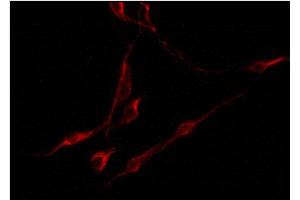 ABIN6274538 staining U87 by IF/ICC. (EPH Receptor A6 antibody)