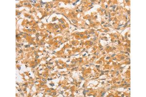 Immunohistochemistry (IHC) image for anti-Toll-Like Receptor 3 (TLR3) antibody (ABIN2422740) (TLR3 antibody)