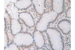 Figure. (SIRT4 antibody  (AA 28-314))