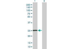 Western Blot analysis of IFNA8 expression in transfected 293T cell line by IFNA8 MaxPab polyclonal antibody.