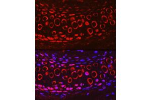 Immunofluorescence analysis of Mouse cartilage using COMP Rabbit pAb (ABIN6127650, ABIN6138864, ABIN6138866 and ABIN6221502) at dilution of 1:200 (40x lens). (COMP antibody  (AA 20-160))