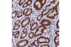 Immunohistochemical staining of human stomach with NSUN6 polyclonal antibody  shows strong granular cytoplasmic positivity in glandular cells at 1:10-1:20 dilution. (NSUN6 antibody)