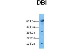 Host:  Rabbit  Target Name:  DBI  Sample Tissue:  Human Ovary Tumor  Antibody Dilution:  1. (Diazepam Binding Inhibitor antibody  (N-Term))