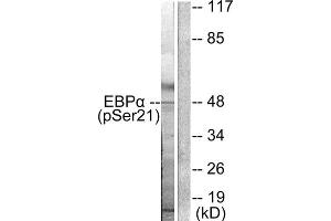 Western blot analysis of extracts from HepG2 cells treated with EGF (200ng/ml, 5mins), using C/EBP- alpha (phospho-Ser21) antibody. (CEBPA antibody  (pSer21))