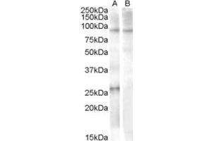 Western Blotting (WB) image for anti-Apolipoprotein B mRNA Editing Enzyme, Catalytic Polypeptide-Like 2 (APOBEC2) (Internal Region) antibody (ABIN2466475) (APOBEC2 antibody  (Internal Region))