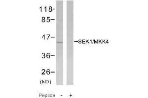 Image no. 2 for anti-Mitogen-Activated Protein Kinase Kinase 4 (MAP2K4) (Ser80) antibody (ABIN197325) (MAP2K4 antibody  (Ser80))