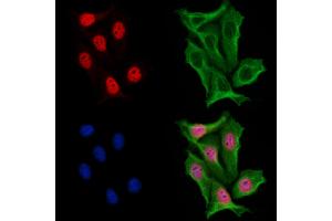 ABIN6254860 and ABIN6267065 staining H2O2 treated Hela cells by IF/ICC. (Histone 3 antibody  (H3K18ac))