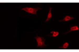 ABIN6274527 staining Hela by IF/ICC. (DNAJC17 antibody  (N-Term))