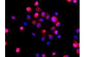 Immunofluorescence (IF) image for anti-Colony Stimulating Factor 1 Receptor (CSF1R) antibody (Alexa Fluor 594) (ABIN2656811) (CSF1R antibody  (Alexa Fluor 594))
