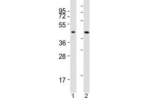 Western blot testing of ACAT1 antibody at 1:2000 dilution. (ACAT1 antibody  (AA 296-329))