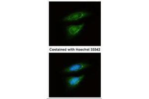 ICC/IF Image Immunofluorescence analysis of methanol-fixed HeLa, using LDH-B, antibody at 1:50 dilution. (LDHB antibody)