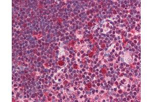 Anti-SNW1 antibody IHC of human thymus. (SNW1 antibody  (C-Term))