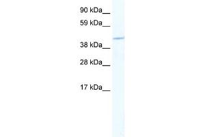 WB Suggested Anti-MEF2C Antibody Titration:  2. (MEF2C antibody  (N-Term))