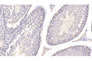Immunohistochemistry (IHC) image for anti-Lactate Dehydrogenase B (LDHB) (AA 1-334) antibody (ABIN7433969)