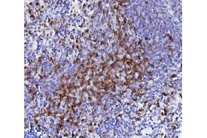 IHC analysis of CD5 using anti-CD5 antibody (ABIN7600841). (CD5 antibody  (AA 24-494))