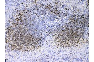 IHC analysis of PAX5 using anti-PAX5 antibody . (PAX5 antibody  (AA 217-282))