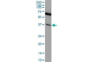 CXCR4 monoclonal antibody (M04), clone 2G9. (CXCR4 antibody  (AA 1-46))