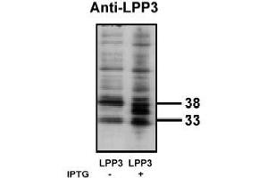Image no. 1 for anti-Phosphatidic Acid Phosphatase Type 2B (PPAP2B) antibody (ABIN265045) (PPAP2B antibody)