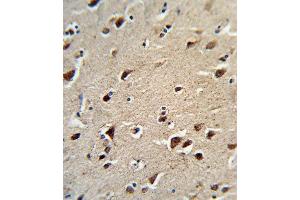 Formalin-fixed and paraffin-embedded human brain tissue reacted with OAT Antibody (N-term), which was peroxidase-conjugated to the secondary antibody, followed by DAB staining. (OAT antibody  (N-Term))