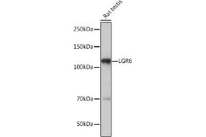 Western blot analysis of extracts of Rat testis, using LGR6 Rabbit mAb (ABIN7268235) at 1:1000 dilution. (LGR6 antibody)