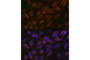 Immunofluorescence analysis of U-251 MG cells using IGFBP7 Rabbit mAb (ABIN7267910) at dilution of 1:100 (40x lens). (IGFBP7 antibody)