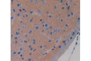 IHC-P analysis of brain tissue, with DAB staining. (CHRDL1 antibody  (AA 272-447))