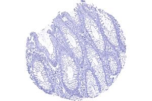 Colon descendes mucosa Calbindin 1 immunostaining is absent in all cells of the colon mucosa (CALB1 antibody  (AA 7-96))