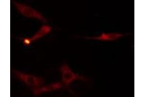 ABIN6275948 staining  HuvEc cells by IF/ICC. (FZD9 antibody  (C-Term))