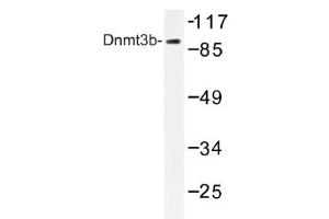 Image no. 1 for anti-DNA (Cytosine-5-)-Methyltransferase 3 beta (DNMT3B) antibody (ABIN317617) (DNMT3B antibody)