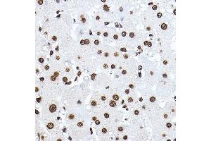 Immunohistochemistry of paraffin-embedded human liver using Histone H3 Rabbit pAb (ABIN3023242, ABIN3023243, ABIN3023244, ABIN1513010 and ABIN6219504) at dilution of 1:100 (40x lens). (Histone 3 antibody  (C-Term))