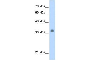 WB Suggested Anti-LDB1 Antibody Titration:  0.