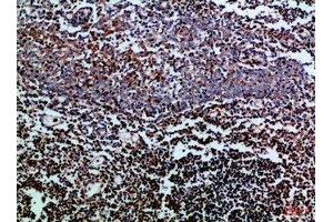 Immunohistochemical analysis of paraffin-embedded Human-tonsil, antibody was diluted at 1:100 (CD247 antibody  (AA 51-100))