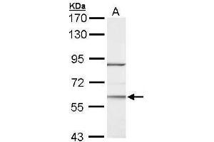 WB Image Sample (30 ug of whole cell lysate) A: Hela 7. (RORA antibody)