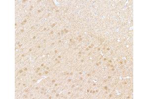 Immunohistochemistry (IHC) image for anti-Ubiquitin Carboxyl-terminal Esterase L1 (Ubiquitin Thiolesterase) (UCHL1) (AA 50-100) antibody (ABIN7449527) (Recombinant UCHL1 antibody  (AA 50-100))