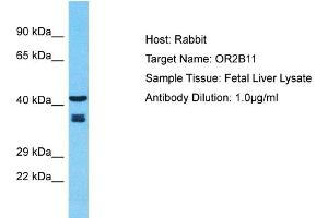 Host: Rabbit Target Name: OR2B11 Sample Type: Fetal Liver lysates Antibody Dilution: 1. (OR2B11 antibody  (C-Term))