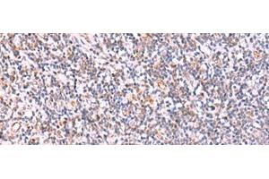 Immunohistochemistry of paraffin-embedded Human tonsil tissue using ITPKC Polyclonal Antibody at dilution of 1:40(x200) (ITPKC antibody)