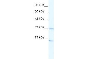 WB Suggested Anti-ZNF265 Antibody Titration:  1. (ZNF265 antibody  (N-Term))