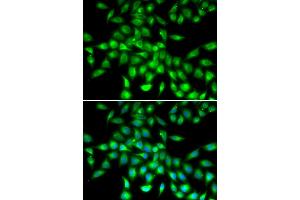 Immunofluorescence analysis of A549 cells using SERPINA10 antibody (ABIN6292722).
