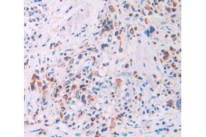 anti-Ribonuclease A12 (AA 21-147) antibody