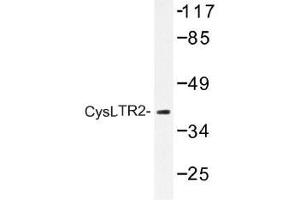 Image no. 1 for anti-Cysteinyl Leukotriene Receptor 2 (CYSLTR2) antibody (ABIN317732) (CasLTR2 antibody)