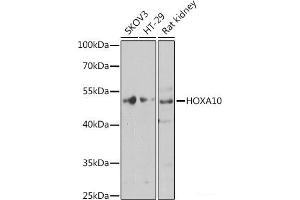 Western blot analysis of extracts of various cell lines using HOXA10 Polyclonal Antibody at dilution of 1:1000. (HOXA10 antibody)