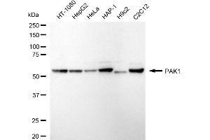 Western blotting analysis using PAK1 antibody (ABIN7799718).