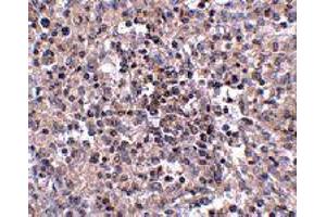 Immunohistochemistry of SLC39A10 in human spleen tissue with SLC39A10 polyclonal antibody  at 2.