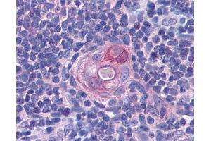 Anti-PYCARD antibody IHC of human thymus. (PYCARD antibody  (AA 31-46))
