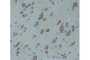 Used in DAB staining on fromalin fixed paraffin- embedded brain tissue (CNTNAP5 antibody  (AA 25-302))