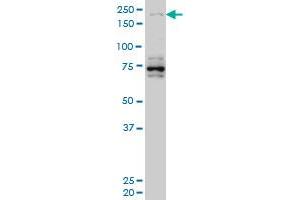 Western Blotting (WB) image for anti-Helicase with Zinc Finger (HELZ) (AA 1-101) antibody (ABIN599500) (HELZ antibody  (AA 1-101))