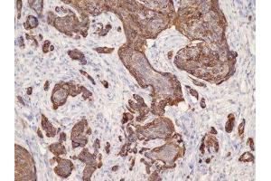 Immunohistochemistry (IHC) image for anti-Keratin 17 (KRT17) (C-Term) antibody (ABIN870563) (KRT17 antibody  (C-Term))