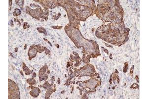 Immunohistochemistry (IHC) image for anti-Keratin 17 (KRT17) (C-Term) antibody (ABIN870564) (KRT17 antibody  (C-Term))