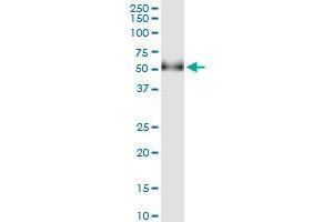 Immunoprecipitation of GAK transfected lysate using anti-GAK MaxPab rabbit polyclonal antibody and Protein A Magnetic Bead , and immunoblotted with GAK purified MaxPab mouse polyclonal antibody (B01P) . (GAK antibody  (AA 1-416))